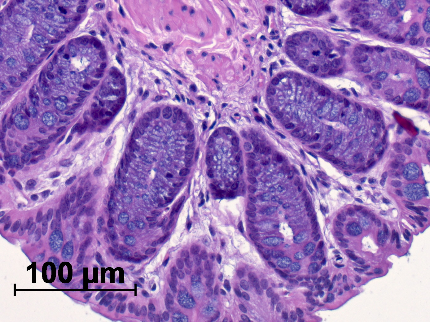 Towards entry "Minimizing transplantation risks"