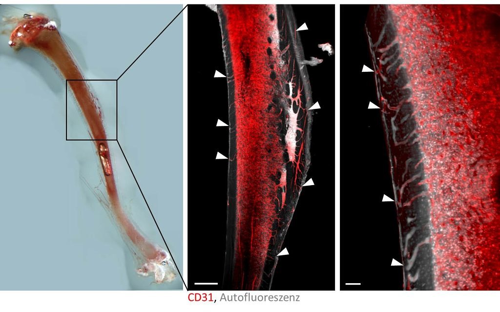 Towards entry "News  Discovery of blood vessel system in bones"