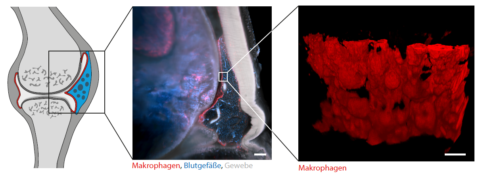 Towards entry "Inflammation in 3D"