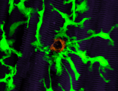 Towards entry "Tissue Imaging in Inflammation"